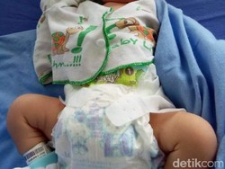 Bupati Cellica Rawat Bayi Lucu yang Ditemukan di Kolong Jembatan