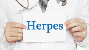 Ini Cirinya Terkena Herpes Genital