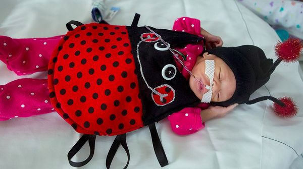 Super Cute! Penampilan Bayi Prematur Berkostum Halloween