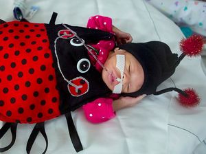 Super Cute! Penampilan Bayi Prematur Berkostum Halloween Super Cute! Penampilan Bayi Prematur Berkostum Halloween