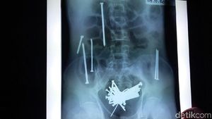 Ini Paku-paku yang Dimakan Wawan hingga Akhirnya Tewas