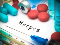 4 Fakta Terkait Penyakit Herpes Genital