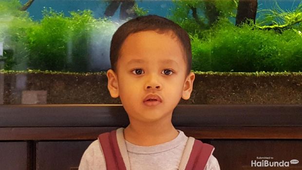 Ilustrasi anak mengidap penyakit gondongan