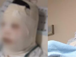 Tragis, Jelang Nikah Wanita Ini Malah Disiram Kuah Ramen Panas oleh Temannya