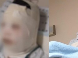 Tragis, Jelang Nikah Wanita Ini Malah Disiram Kuah Ramen Panas oleh Temannya