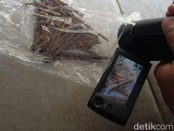 Ini Wujud 48 Paku yang Dikeluarkan Dokter Dalam Perut Wawan