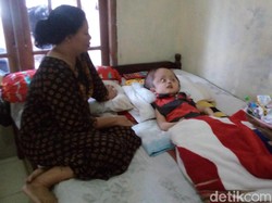 Menengok Fahri, Bocah Penderita Hydrocephalus di Semarang