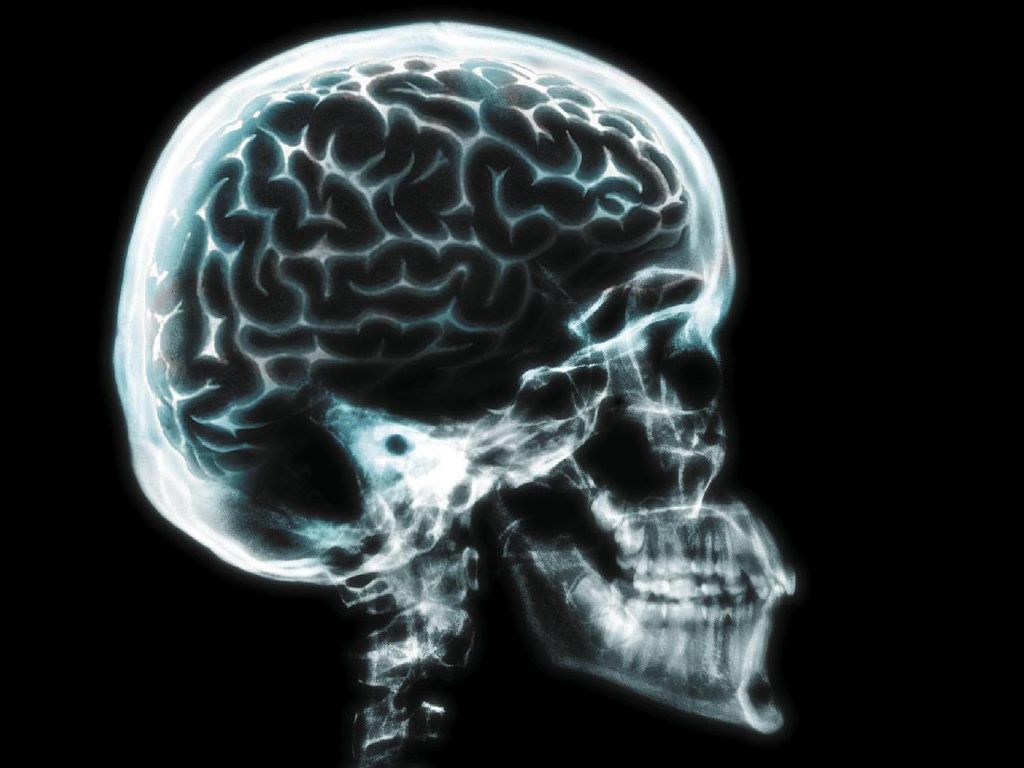 Benarkah Ukuran Otak Manusia Sudah Menyusut Hampir 4 Kali Lipat?