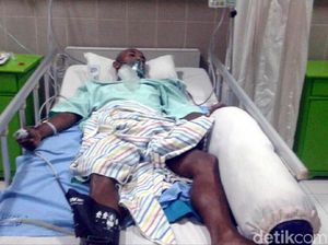 Tersambar Petir, Warga Kebumen Nyaris Tewas