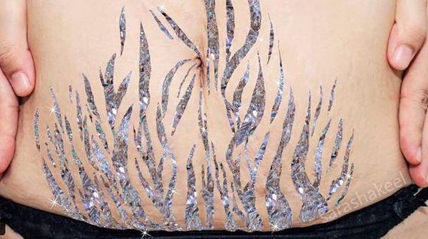 Foto: Cantiknya Penampakan Stretch Mark