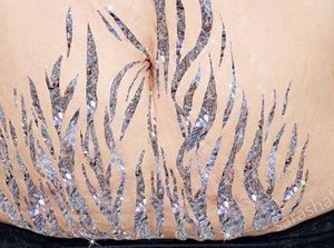 Foto: Cantiknya Penampakan Stretch Mark