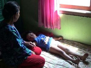 Ini Kata Dinkes Soal Bocah Tanpa Anus di Banyuwangi