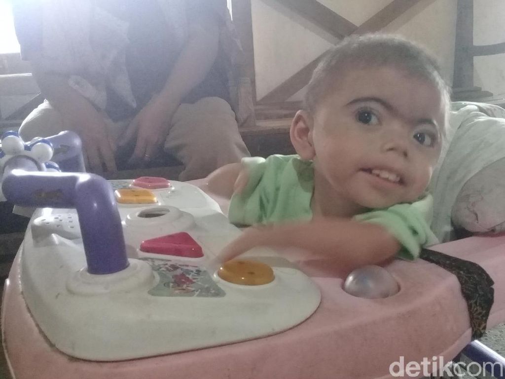 Terkendala Biaya Penyebab Rifki Tidak Dirujuk Lagi ke RSU Soetomo Terkendala Biaya Penyebab Rifki Tidak Dirujuk Lagi ke RSU Soetomo