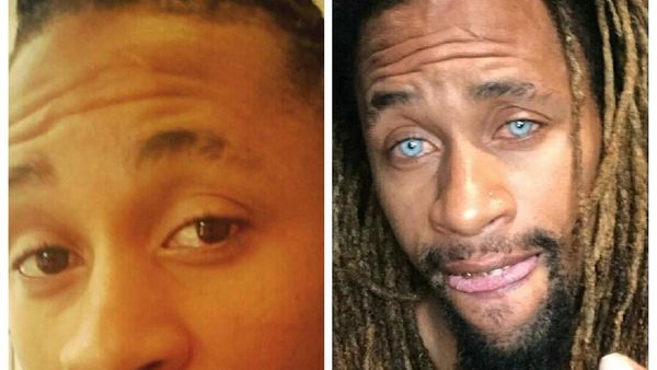 Foto: Pakai Laser, Orang-orang Ini Mengganti Permanen Warna Matanya