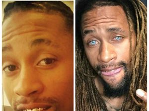 Foto: Pakai Laser, Orang-orang Ini Mengganti Permanen Warna Matanya