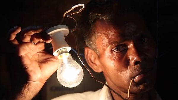 Foto: Punya Kebiasaan Aneh, Pria Ini Mengaku Gemar Makan Listrik