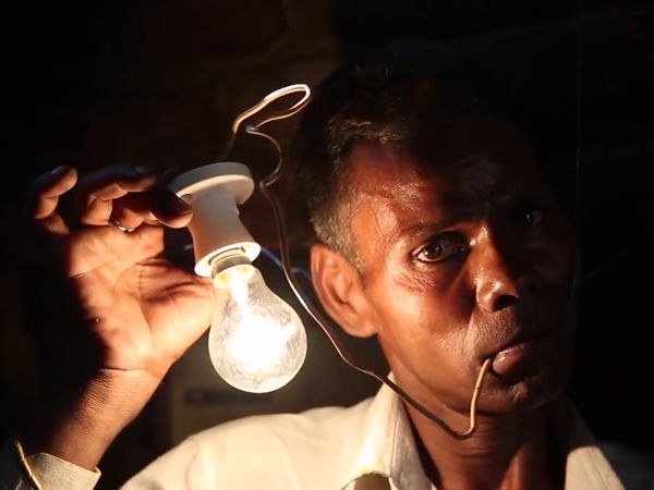 Foto: Punya Kebiasaan Aneh, Pria Ini Mengaku Gemar Makan Listrik