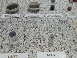 5 Mahasiswa UWM Teliti Jinten Hitam Berkhasiat Antikanker