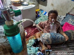 Sofyan, Bocah 14 Tahun Ini Idap Gagal Ginjal dan Hipertensi