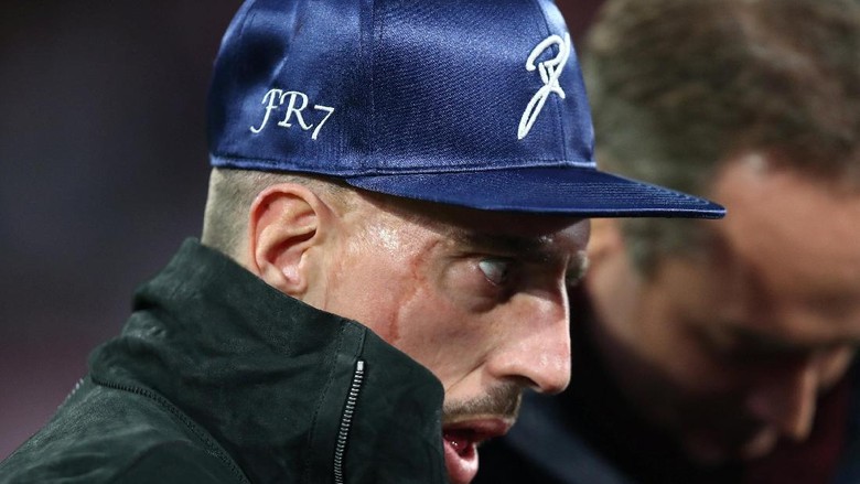Ribery Tak Mau Buru-Buru Main Lagi Ribery Tak Mau Buru-Buru Main Lagi