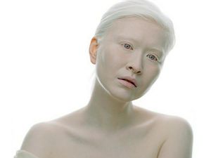 Tubuhnya Serba Putih, Wanita Ini Jadi Model Pertama dengan Albinisme Tubuhnya Serba Putih, Wanita Ini Jadi Model Pertama dengan Albinisme