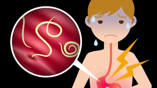 parasitic worm and food poisoning. anisakis. anisakiasis.