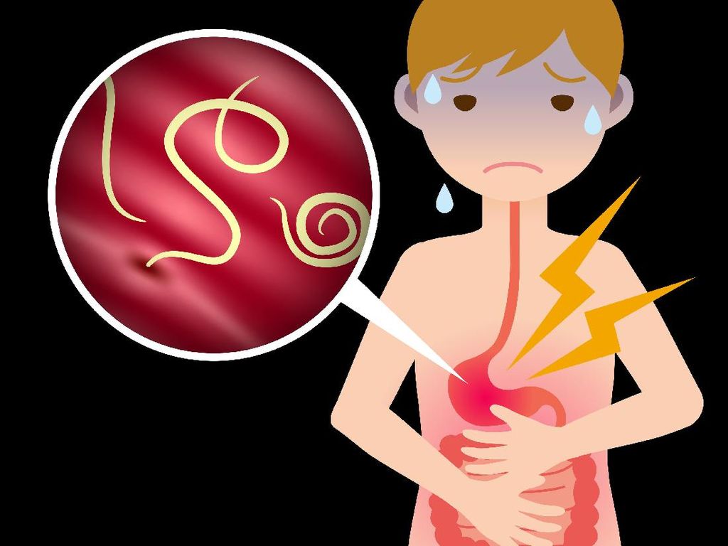 Terinfeksi Ratusan Cacing, Bocah Ini Nyaris Meninggal Terinfeksi Ratusan Cacing, Bocah Ini Nyaris Meninggal