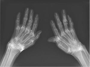 Pergelangan Wanita Ini Diisi Benang Emas dari Sisa Akupunktur