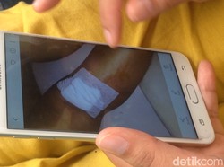 Adik Tunjukkan Foto Luka dr Letty Gara-gara dr Helmi