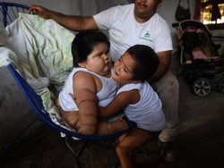 Idap Sindrom Langka, Bayi Raksasa Ini Bobotnya 28 Kg di Usia 10 Bulan