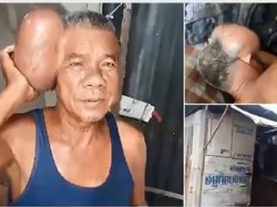 Kondisi Aneh Buat Kakek Asal Thailand Dijuluki Pria Berkepala Dua