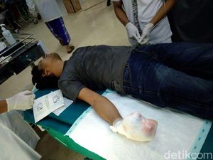 Begini Kronologi Polisi Jadi Korban Ledakan Petasan Begini Kronologi Polisi Jadi Korban Ledakan Petasan