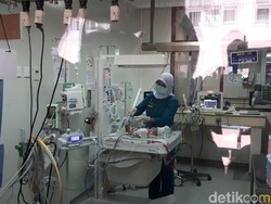 RSHS Sudah Tangani 11 Bayi Kembar Siam, Asal Padalarang Terberat