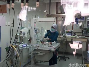 RSHS Belum Putuskan Tindakan untuk Bayi Kembar Siam Asal Padalarang RSHS Belum Putuskan Tindakan untuk Bayi Kembar Siam Asal Padalarang
