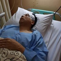 Setnov Kecelakaan, Tiang Listrik dan Fortuner Jadi Korban