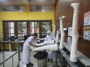 Kisaran Harga Kaki Palsu, Ditanggung BPJS Kesehatan Nggak? Kisaran Harga Kaki Palsu, Ditanggung BPJS Kesehatan Nggak?