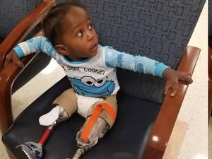 Ini Jaylen, Bisa Jalan Lagi Setelah Diamputasi Karena Kondisi Langka Ini Jaylen, Bisa Jalan Lagi Setelah Diamputasi Karena Kondisi Langka