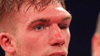 Pelipis kiri petinju Nick Blackwell mengalami bengkak cukup besar. (Independent)