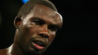 Petinju Hasim Rahman juga pernah dapat benjol sebesar bakpau. Cedera ini dia dapat karena berbenturan kepala dengan Evander Holyfield dalam duel di 2002 lalu. (scifighting)