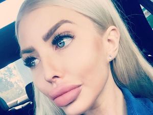 Foto: Ini Anella, Wanita yang Terobsesi Jadi Barbie Hidup Pertama di Dunia