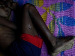 Krisis Rohingya, Mereka yang Dipukuli dan Dibakar