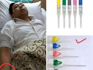 Viral Postingan Dokter Soal Jarum Infus Setya Novanto Sebelum Dipindahkan ke RSCM