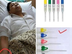 Viral Postingan Dokter Soal Jarum Infus Setya Novanto Sebelum Dipindahkan ke RSCM
