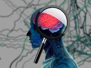 Kesaksian Dokter Tangani Pasien Termuda Alzheimer, Umurnya Masih 19 Tahun Kesaksian Dokter Tangani Pasien Termuda Alzheimer, Umurnya Masih 19 Tahun