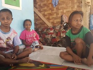 Pasangan di Serang Ini Miliki 3 Anak Berukuran Mini