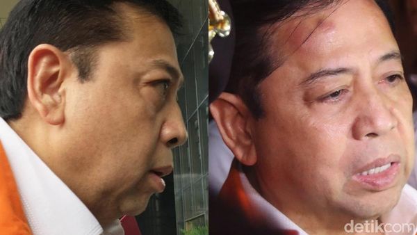 Membandingkan Foto Dahi Novanto Kemarin dan Hari ini