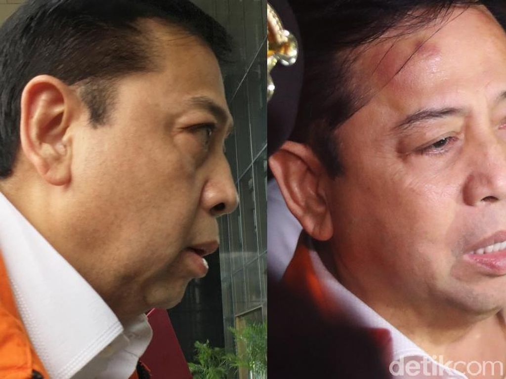 Benjol Sebesar Bakpao, Normalnya Berapa Lama Bisa Hilang? Benjol Sebesar Bakpao, Normalnya Berapa Lama Bisa Hilang?