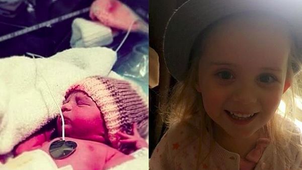 Dulu Lahir Prematur, Kini Bocah-bocah Ini Lucu dan Menggemaskan