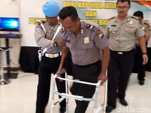 Dua Anggota Dapat Bantuan Kaki Palsu, Ini Pesan Kapolda Jatim