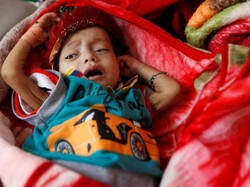 Mengenaskan! 5 Ribu Anak Tewas atau Terluka dalam Perang Yaman